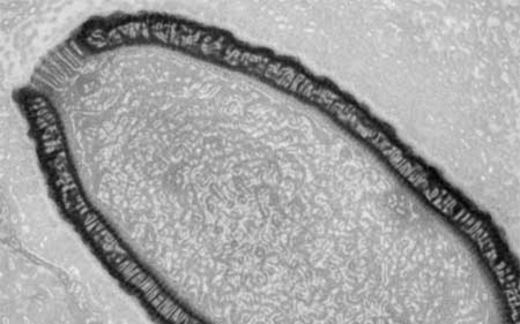 Virus 'khổng lồ' sống lại sau 30.000 năm