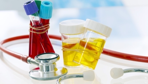 Tổng hợp về các xét nghiệm máu và nước tiểu