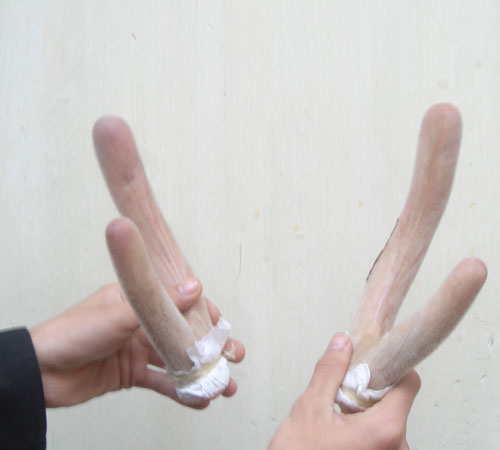 Tử vong vì uống nhung hươu làm tăng chức năng quý ông