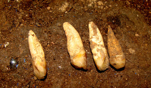 Kinh dị những bộ hàm và cuộc sưu tập răng người