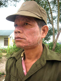 Sống chung với “thần chết”