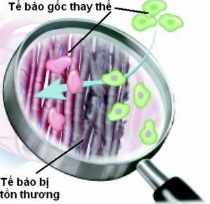 Đái tháo đường và câu chuyện tế bào gốc