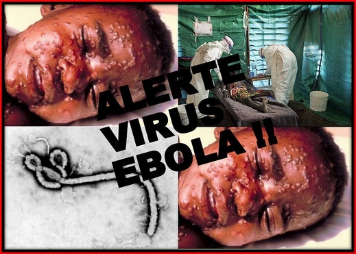 Dấu hiệu nhận biết sớm người nhiễm Ebola trong thời gian ủ bệnh