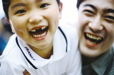 Răng mọc lệch trẻ dễ nói ngọng