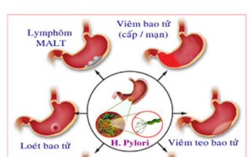 Tránh xa sát thủ vô hình
