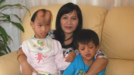 Kết nối vòng tay nhân ái