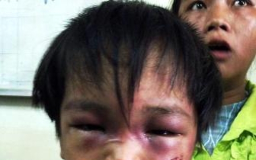 Mừng công dân thứ 90 triệu, lo những gương mặt trẻ em