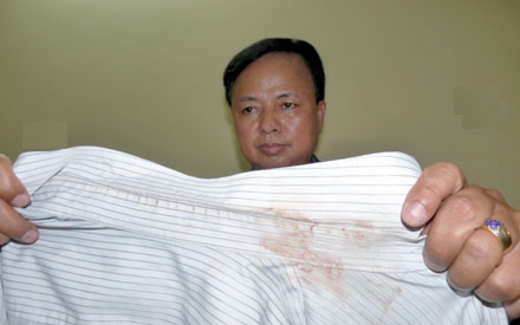 Đến trụ sở công an làm việc, về bằng... xe cứu thương