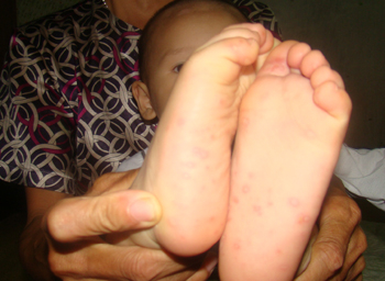 “Tiến sĩ xin đi tù” nổi giận sau cuộc điện cho GĐ Sở Y tế