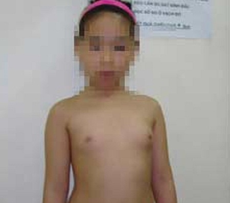 Dậy thì sớm và mối lo hóa chất độc hại rình rập trẻ