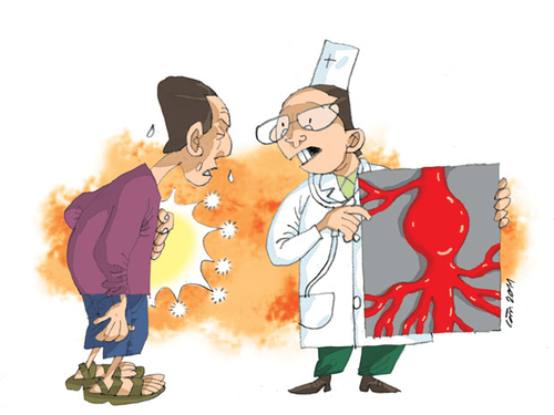 Hai bệnh nguy hiểm từ mạch máu lớn nhất