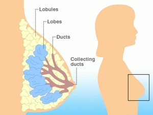 Ít tập luyện, không cho con bú dễ bị ung thư vú