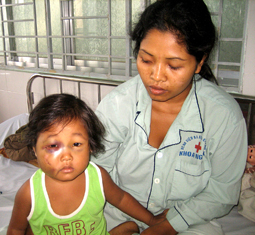 Sống trong vùng voi dữ