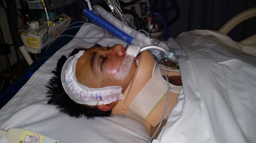 Một du học sinh VN bị hành hung dã man ở Úc