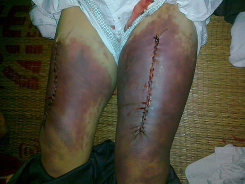 Khởi tố, tạm giam 4 công an xã đánh chết người