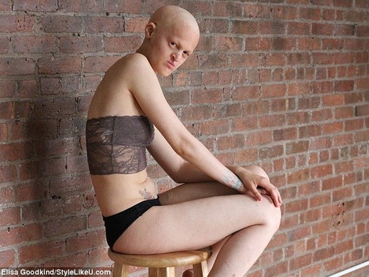 Người mẫu bị dị tật bẩm sinh cởi đồ nhằm phản đối kỳ thị