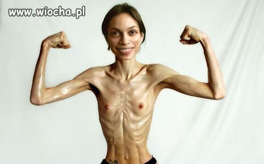 Đề phòng Hội chứng chán ăn tâm thần (Anorekcja)