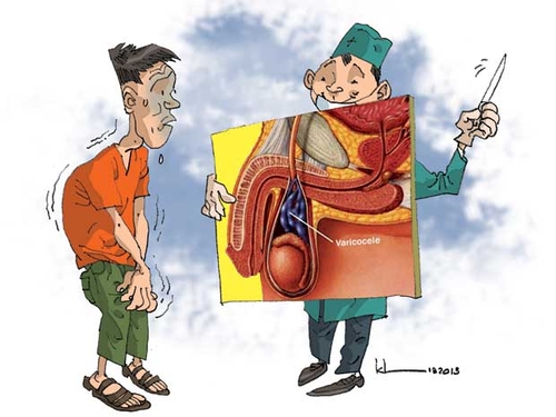 Giãn tĩnh mạch thừng tinh: đừng quá lo!