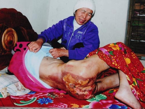 Khởi tố, bắt tạm giam chủ nhà bạo hành dã man người giúp việc