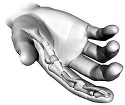 Không hảo ngọt vẫn bị tiểu đường