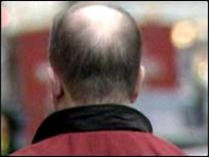 Mẹo hay chống rụng tóc cho quý ông