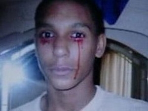 Cậu bé 15 tuổi ở Mỹ khốn khổ vì khóc ra máu