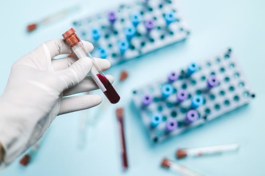 Vấn đề cục máu đông ở người hồi phục sau COVID-19