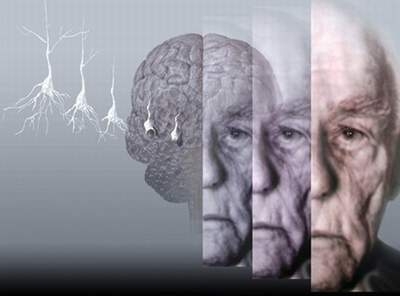 Xóa tan nỗi lo “mất trí”