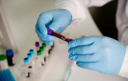 Tế bào lympho là gì? Khi mức của chúng tăng cao hay quá thấp thì đó là một dấu hiệu xấu